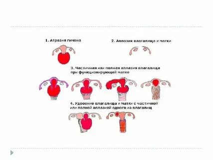 Половое место у девушки