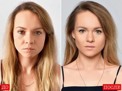 Худые лица до и после