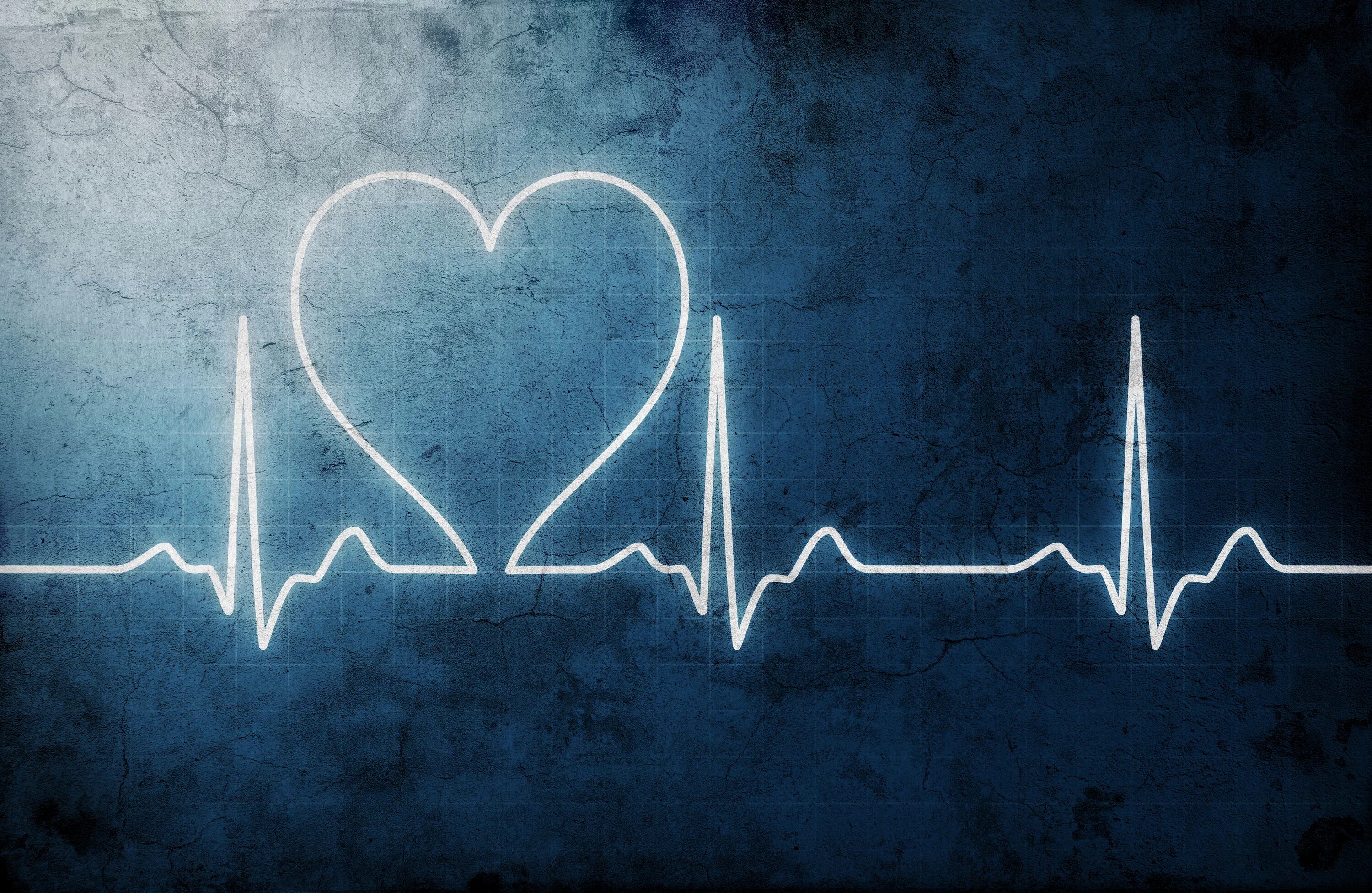 Пульс сердца. Кардиограмма сердца. Красивая кардиограмма. Пульс картинка.