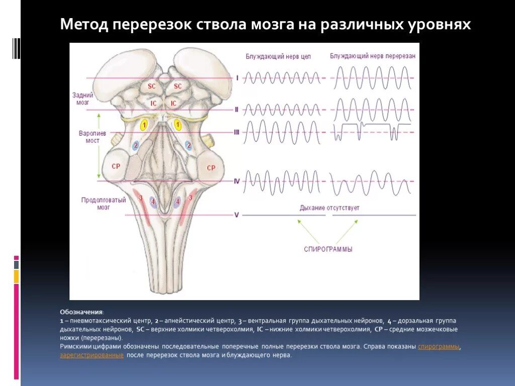 Перерезка продолговатого мозга. Перерезка продолговатого мозга дыхание. Влияние перерезок на разных уровнях ствола мозга на дыхание. Опыты с перерезкой ствола мозга. Перерезка продолговатого мозга.