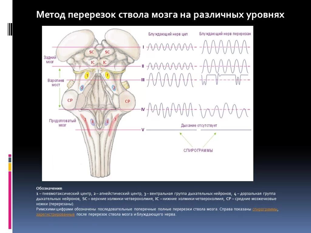 Перерезка продолговатого мозга. Метод перерезки ЦНС. Вентральная группа дыхательных нейронов. Ствол на уровне продолговатого мозга.