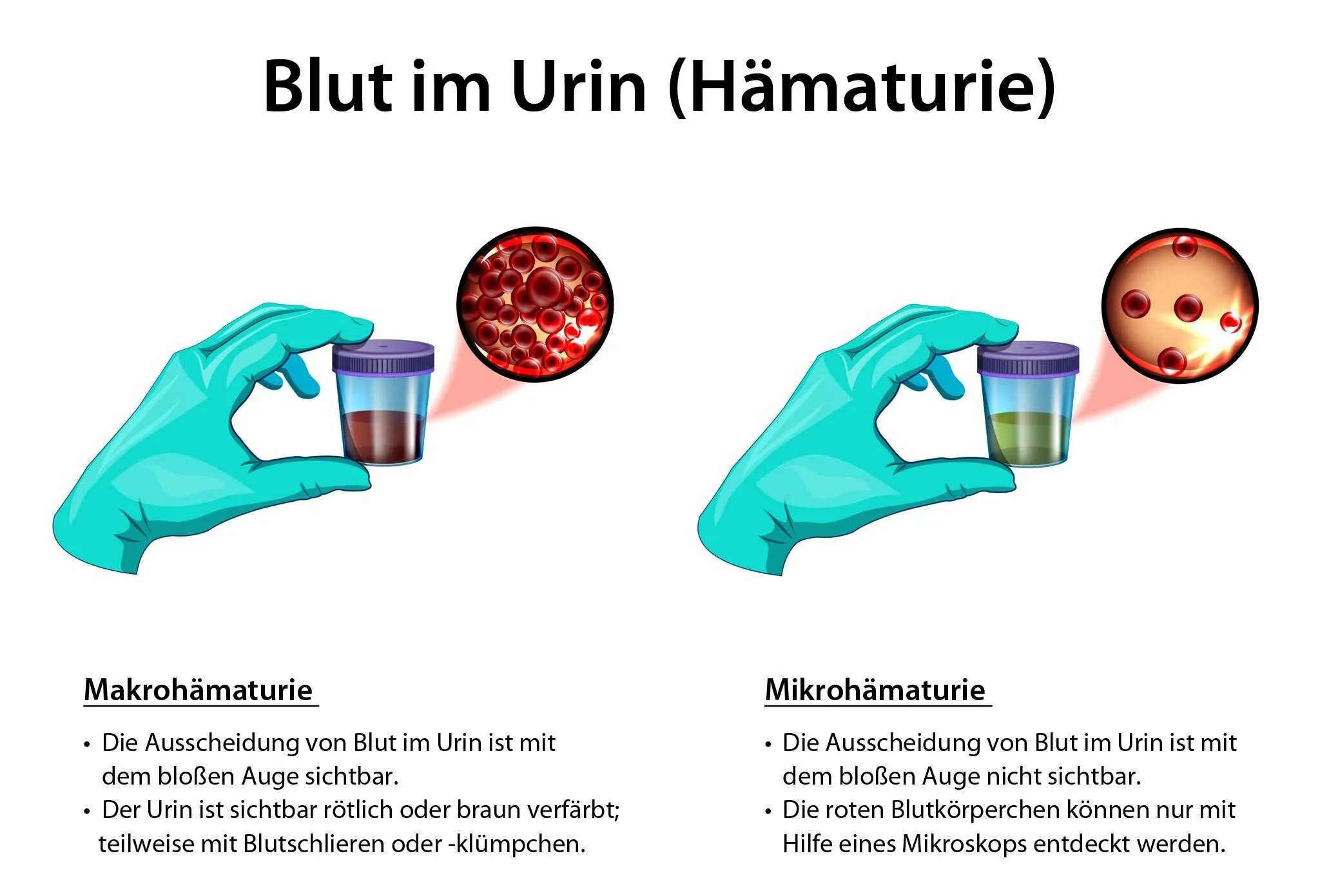 Почему после свеклы моча красная. Blut перевод. Blut Protocol. Моча сильно пахнет аммиаком