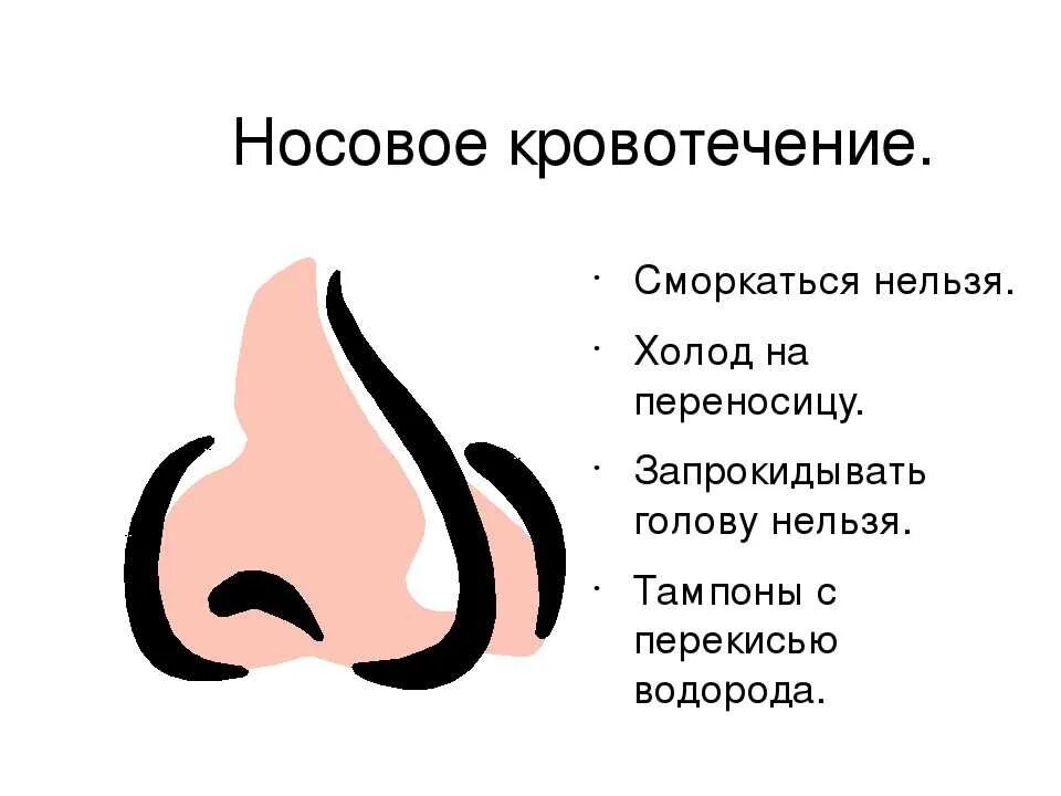 Острое носовое кровотечение. Нососовое кровотечение. Симптомы носового кровотечения.