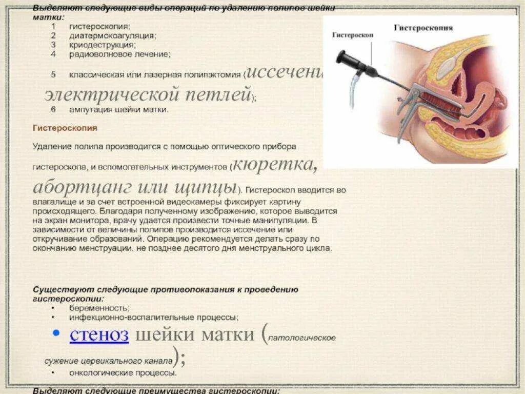 Полип эндометрия гистеро. Операция гистероскопия полипа. Гистероскопия полипа шейки матки. Удаление полипа цервикального канала гистероскопия. Гистероскопия операция удаления полипа