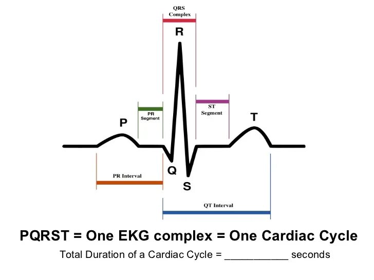 Комплекс QRS норма. Комплекс QRS на ЭКГ. Расшифровка ЭКГ QRS. Формы комплекса QRS на ЭКГ.