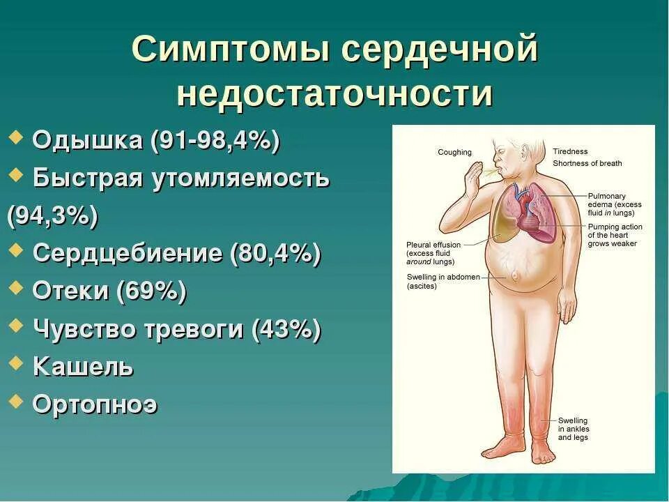 Отеки при хсн