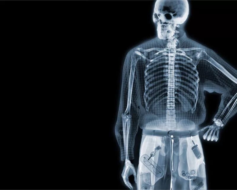 Xray man