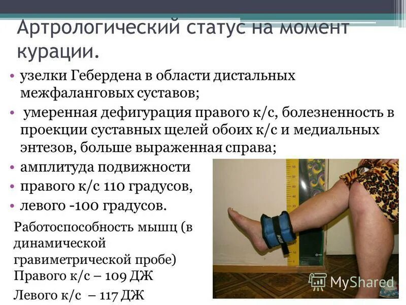 Суставы при сахарном диабете 2 типа. Физические нагрузки. Суставы при сахарном диабете 2 типа. Спортивные люди в возрасте. Суставы при сахарном диабете 2 типа.