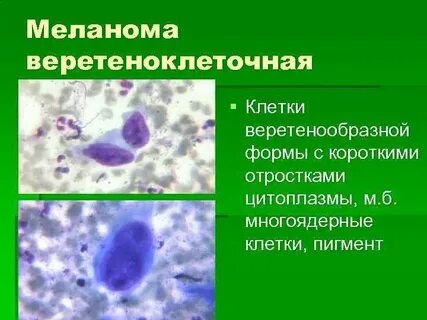 Длинные многоядерные клетки какая ткань