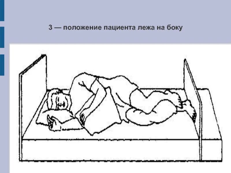 Положение симса предполагает размещение пациента в постели. Положение на боку пациента в постели. укладывание пациента на бок. перемещение и размещение пациента пациента в постели. положение пациента лежа на боку.