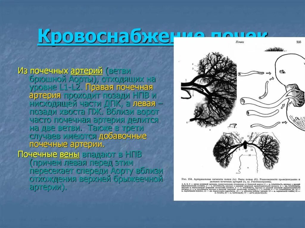 Раннее деление почечной артерии. Почечная артерия является ветвью. 2 Правые почечные артерии. Добавочная правая почечная артерия.