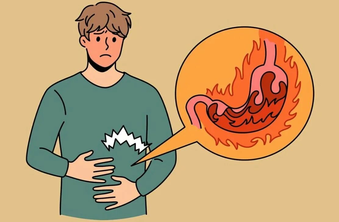Изжога рисунок. Изжога фон. Заболевание желудка рисунок. Изжога фон. Желудочно кишечный тракт курильщика.