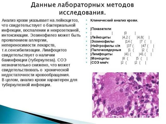 Клинический анализ крови больного туберкулезом. Анализ крови больного туберкулезом показатели. Анализ крови при туберкудез. Изменения в анализе крови при туберкулезе. Лейкоцитоз показатели