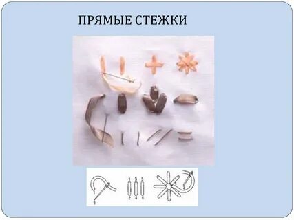 Прямой стежок