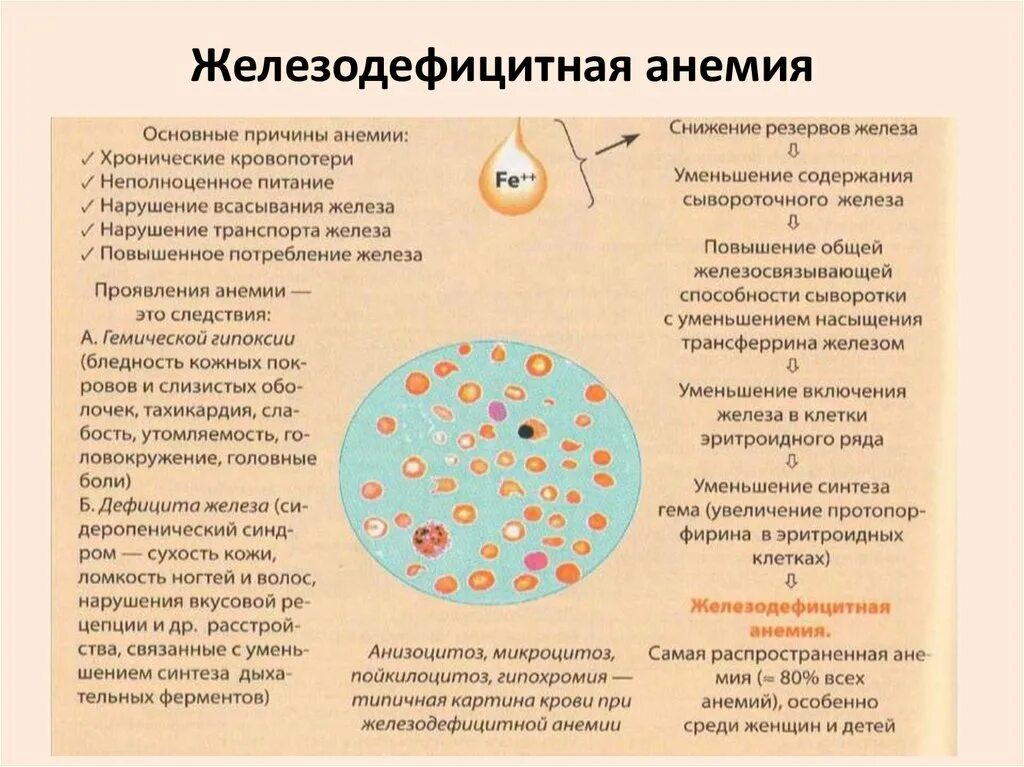 Анизоцитоз при железодефицитной анемии. Анизоцитоз и пойкилоцитоз при анемии. Кожные проявления при железодефицитной анемии.