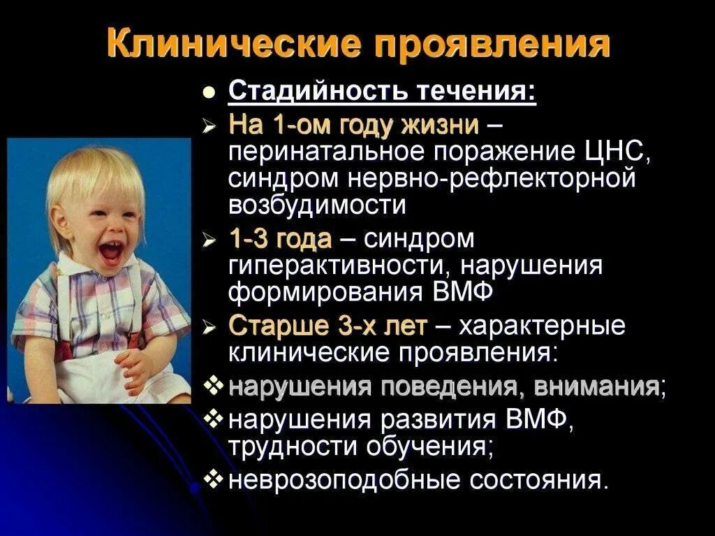 Поражение центральной нервной системы у ребенка