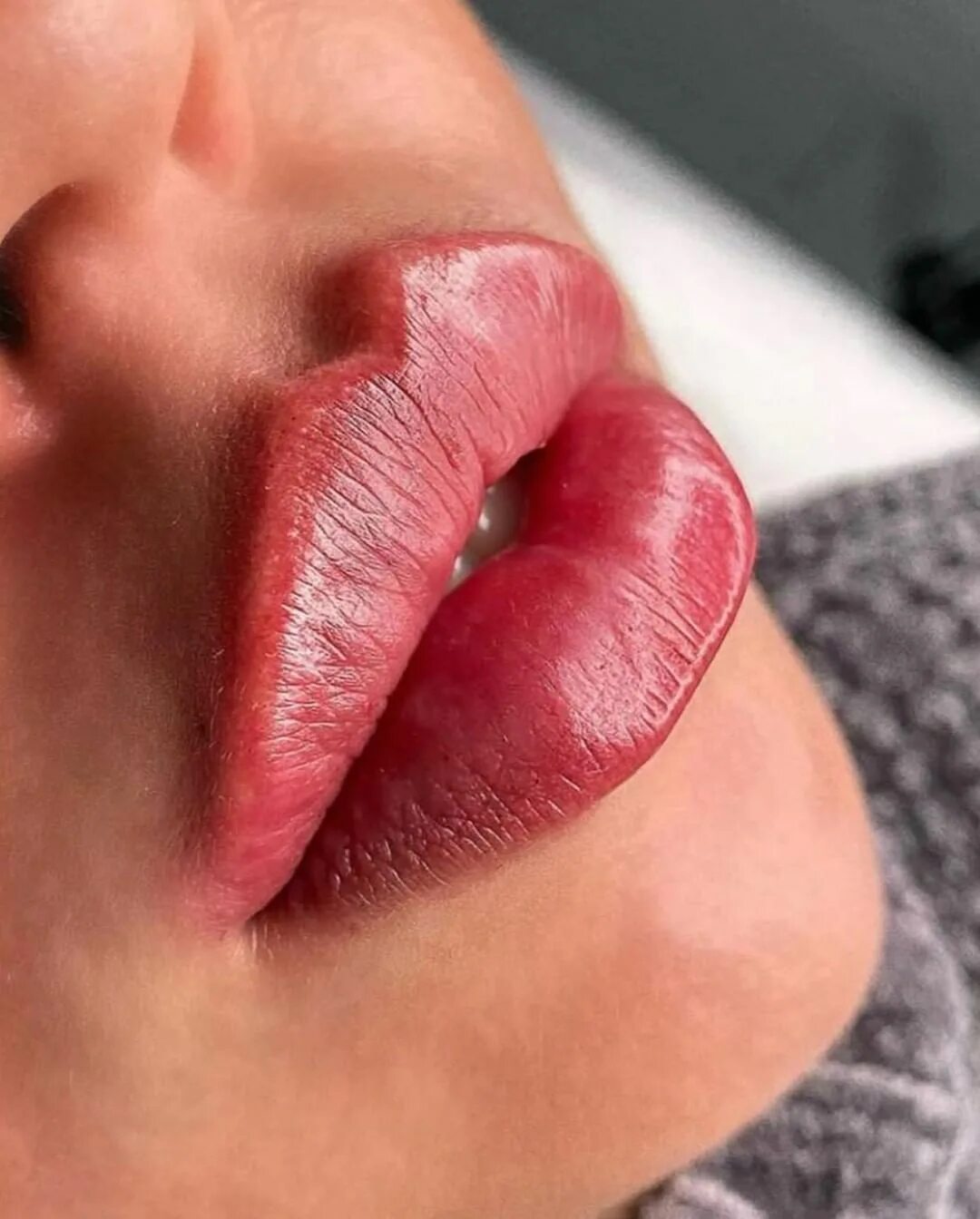 Форма губ бант. Губы бантиком.