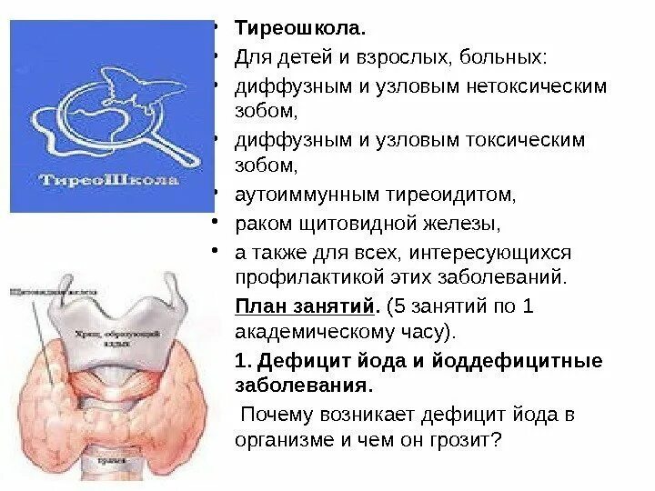 Нетоксический зоб щитовидной. Нетоксический одноузловой зоб. Узловой нетоксический зоб щитовидной железы. Компрессия узлового зоба.