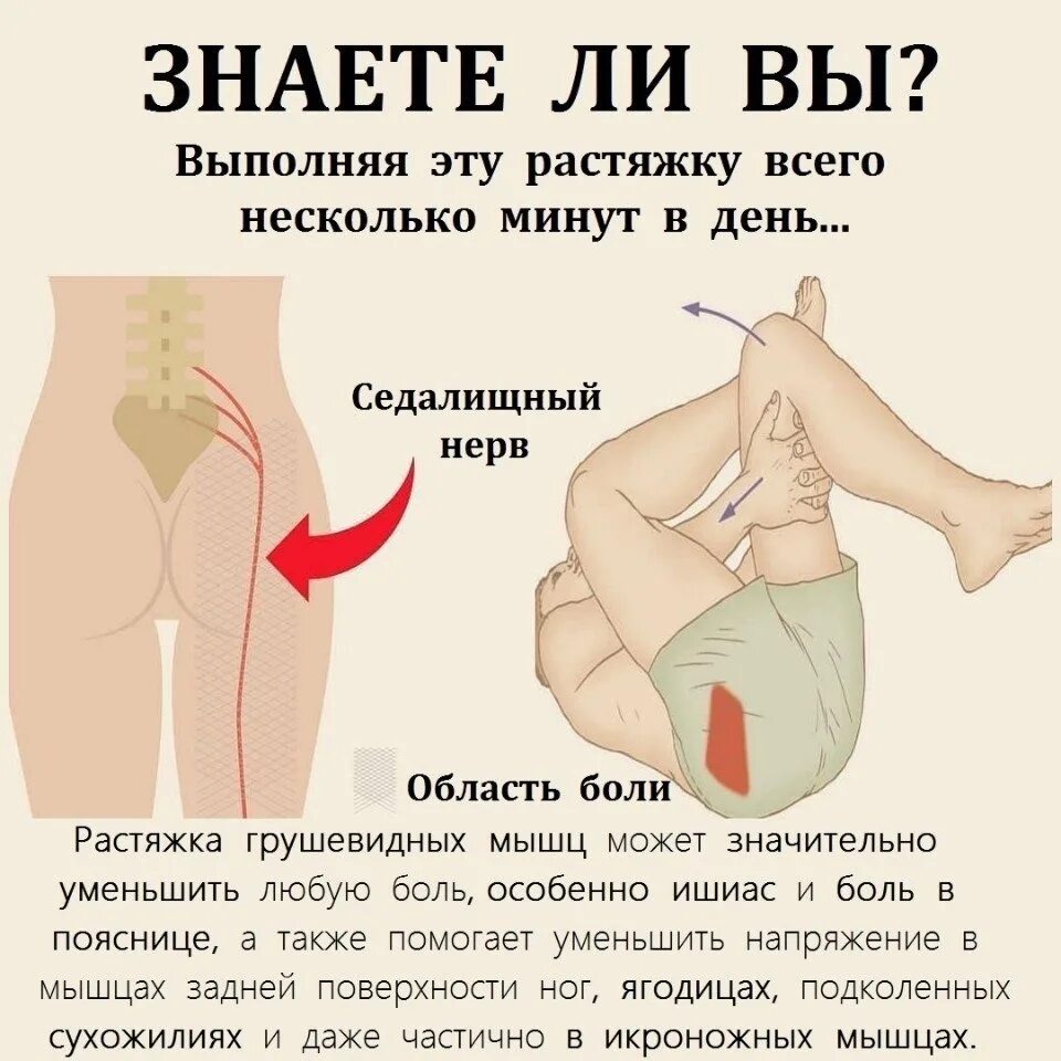 Можно ли греть при защемлении. Упражнения для седалищного нерва. Болит седалищный нерв упражнения. Растяжка при боли в седалищном нерве. Растянуть седалищный нерв.