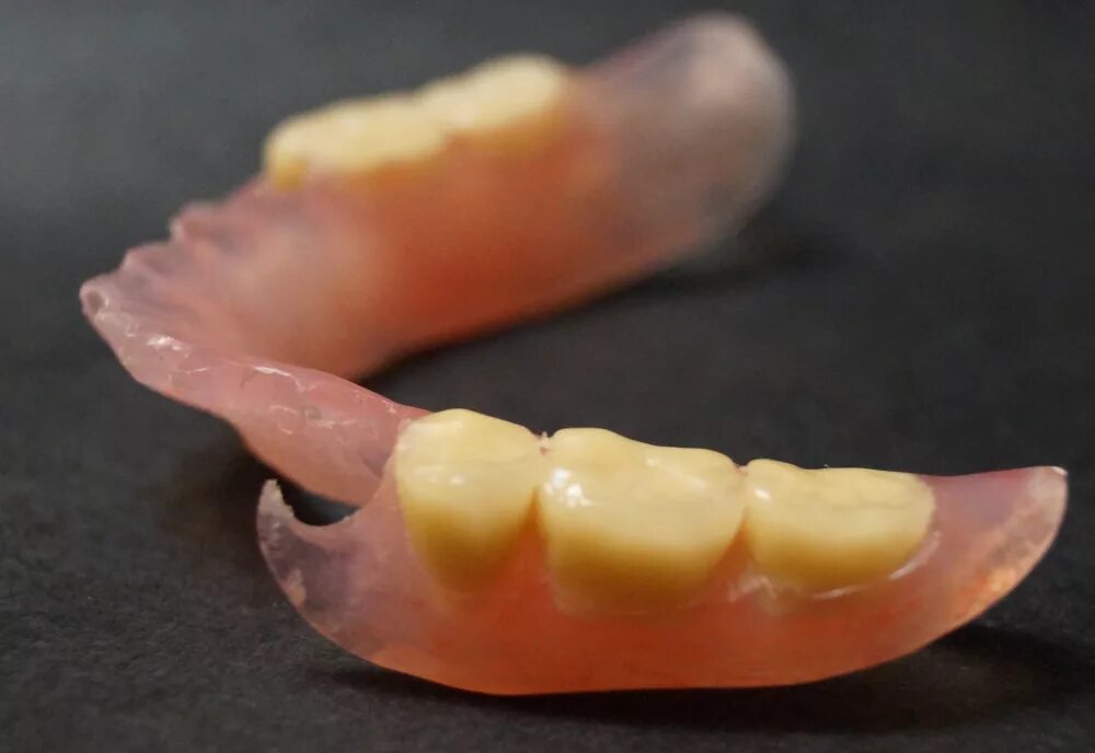 Снимать ли зубные протезы на ночь. Пластинчатый микропротез. Пластиночный протез на 1-2 зуба. Частичный пластиночный протез на нижнюю челюсть. Съемный пластиночный протез на нижнюю челюсть.