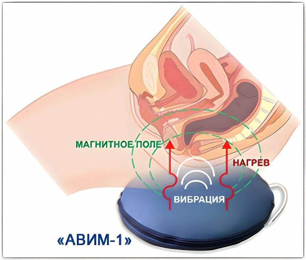 Препараты кровообращение малого таза. Аппарат для циркуляции крови малого таза. Интрамаг в гинекологии. Средства для улучшения кровоснабжения органов малого таза. Прибор улучшения кровообращения в Малом тазу.