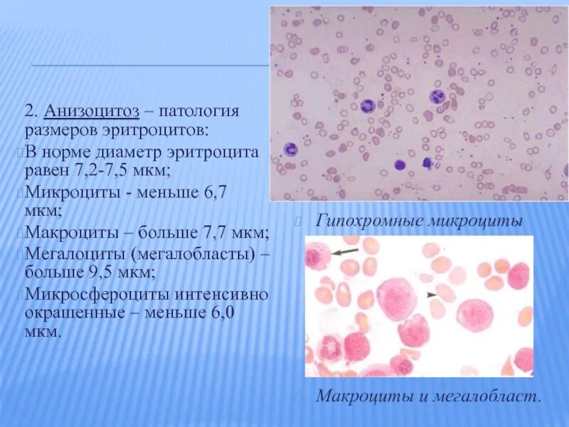 Диаметр эритроцита в норме