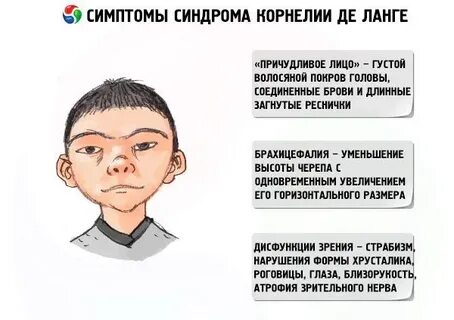 Синдром де