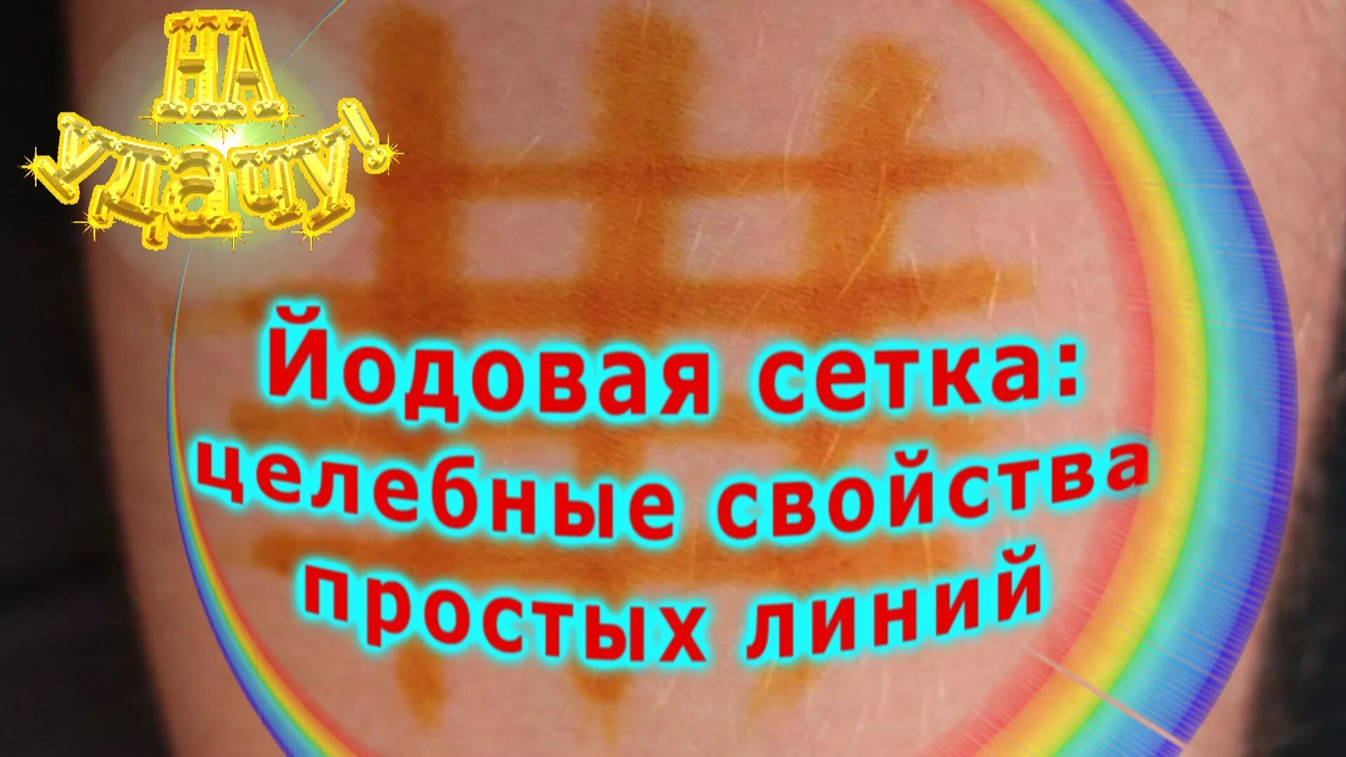 Можно делать йодовую сетку ребенку