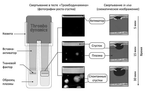 Тромбодинамика