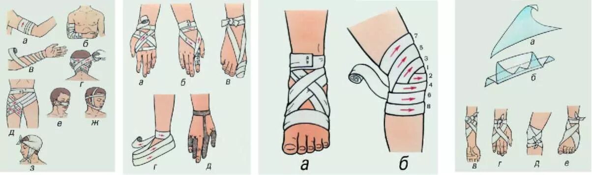 Помощь при перевязке. Повязки на верхнюю конечность десмургия. Перевязка при ранениях и травмах. Повязки при ранениях конечностей. Наложение повязки при ранении конечностей.