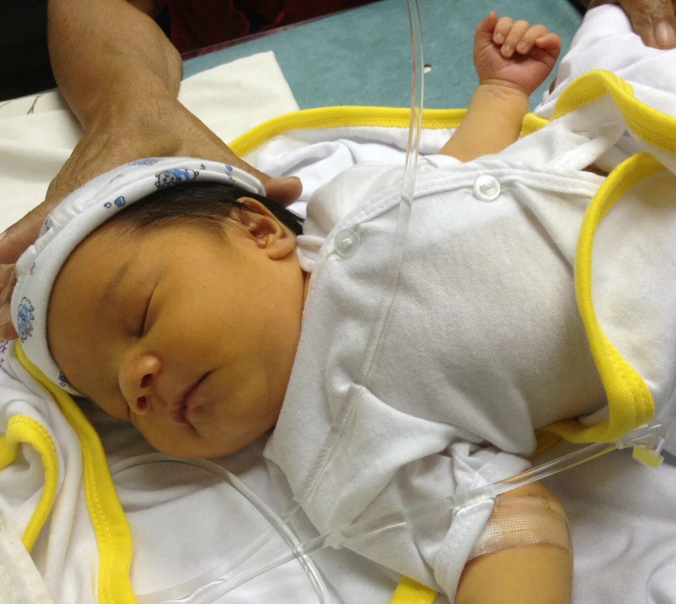 Транзиторная желтуха новорожденных. Физиологическая желтушка у новорожденных. Физиологическая желтухановорожденный. Доктор комаровский о новорожденных с желтушкой. Транзиторная желтуха новорожденных.