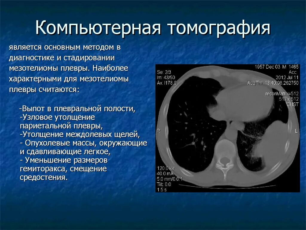 Можно ли кт. Кт легких презентация. Компьютерная томография (кт) презентация. Компьютерная томография это определение.