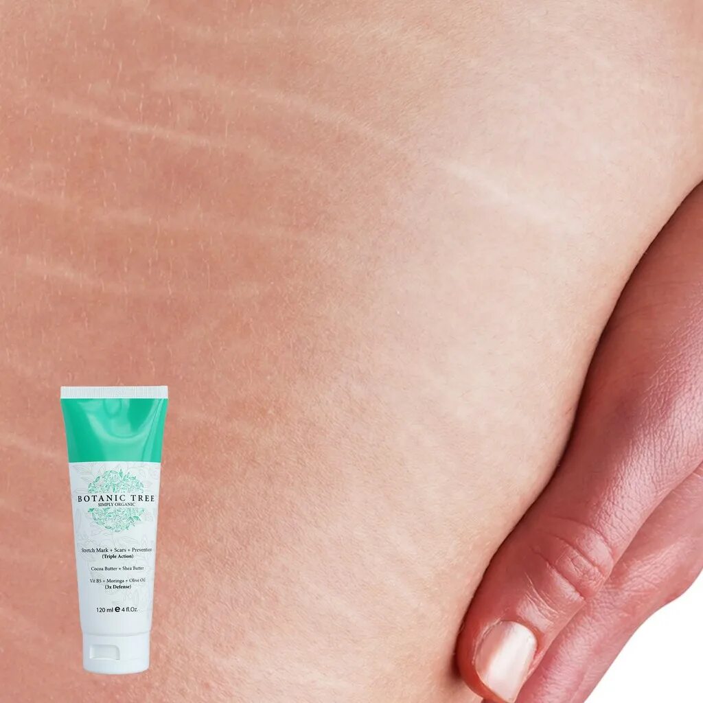 Stretch mark cream. Reviderm stretch Mark Cream. Anti stretch Mark Cream для беременных. Anti stretch Cream malumot.