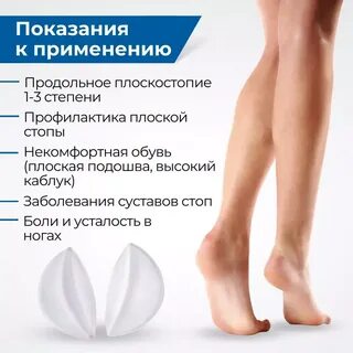 Продольное плоскостопие 1 степени