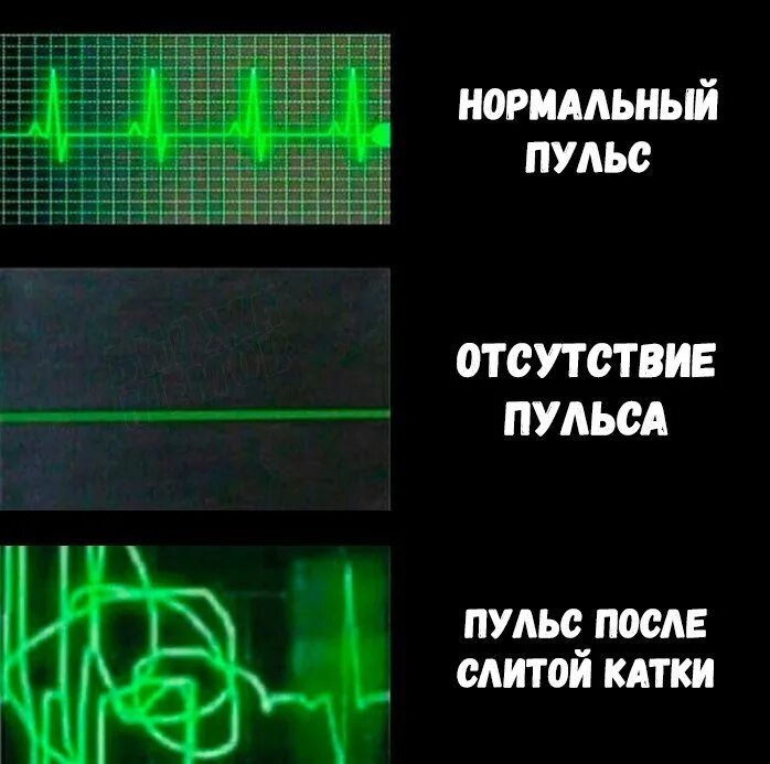 Пульс бьется сильнее. Пульс. Мемы про сердцебиение. Пульс Мем. Нет пульса.