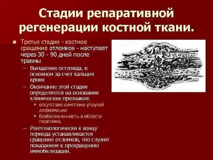 Костная репарация