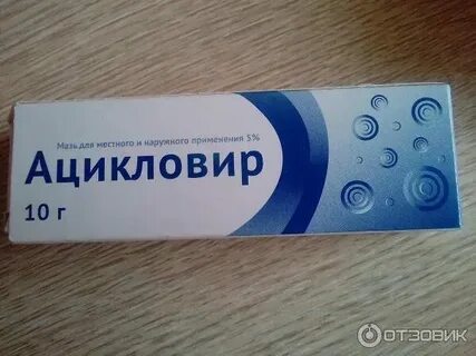 Ветрянка можно мазать ацикловиром