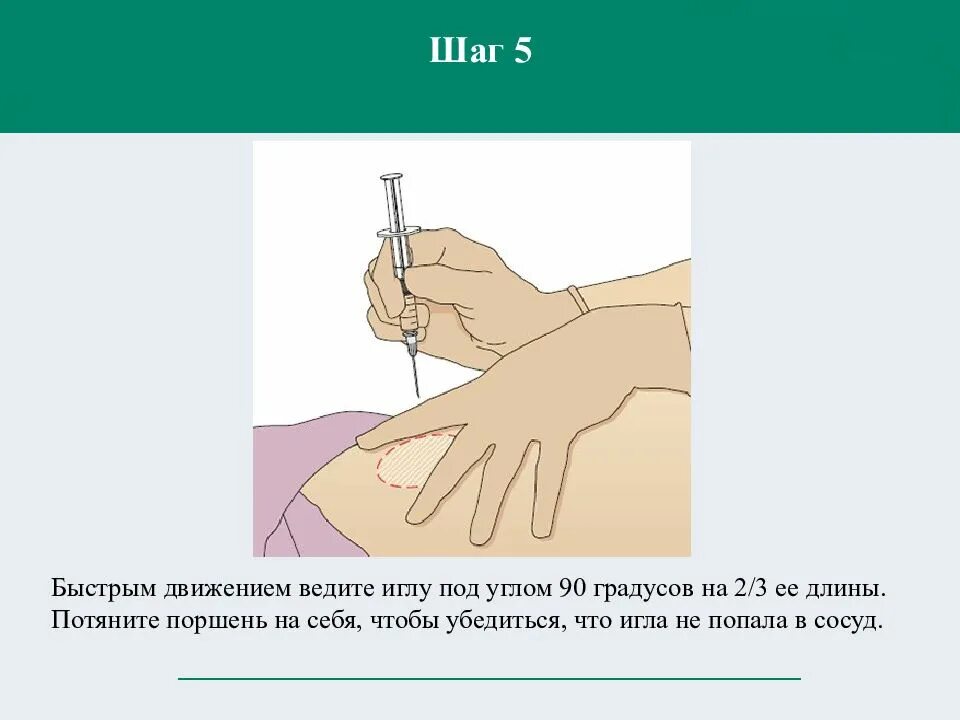 Алгоритм инъекций подкожно внутримышечно внутрикожно. Алгоритм выполнения подкожной инъекции алгоритм. Введение иглы при внутримышечной инъекции. Игла для внутримышечных инъекций вводится.