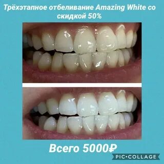 Норма дент отзывы