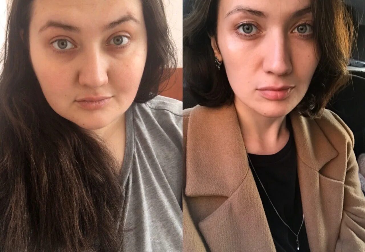 Лицо до и после похудения. Похудение лица до и после фото. Лицо до и после похудения девушки. Худеем в лице. Установленных до и после