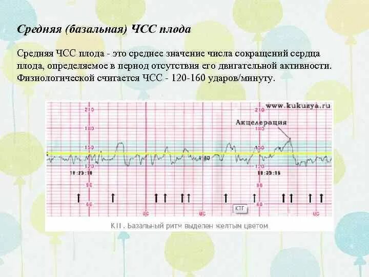 Базальная частота сердцебиения плода КТГ. КТГ базальная ЧСС норма. Базальный ритм на КТГ. Базальная частота сердцебиения плода КТГ нормы. Пульс в 3 триместре