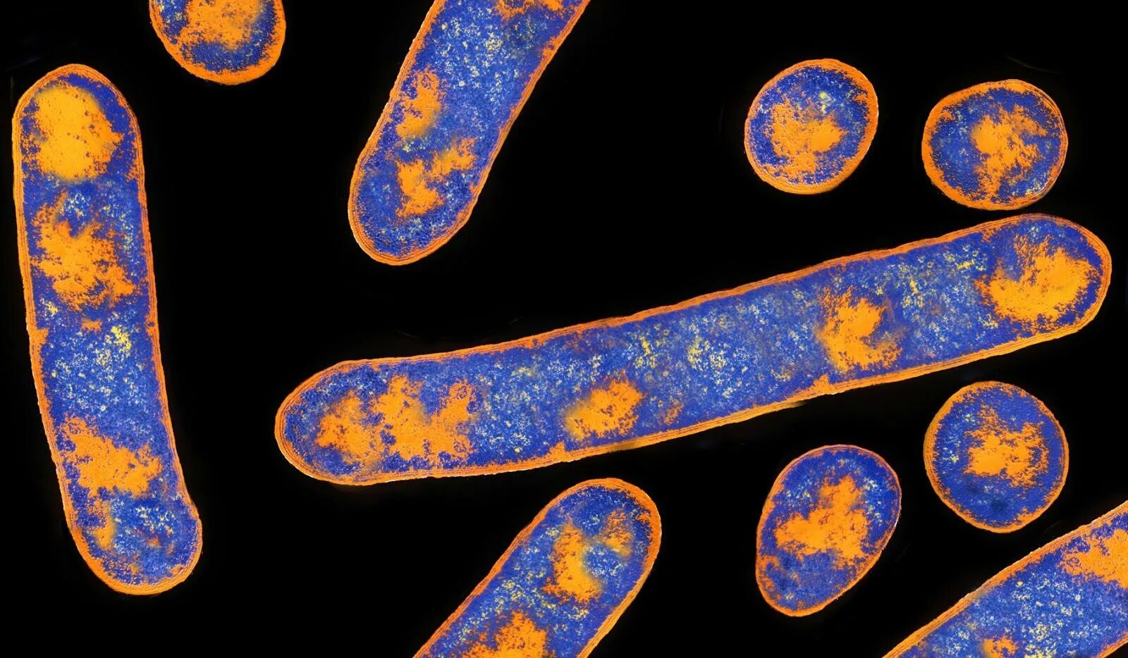 Клостридии ботулизма ( clostridium botulinum ) ботулизм. Бактерия ботулизма. Клостридия ботулинум. Clostridium botulinum возбудитель ботулизма. Токсины возбудителя ботулизма.