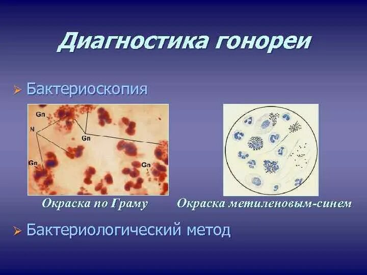 Бактериоскопия. Бактериоскопия