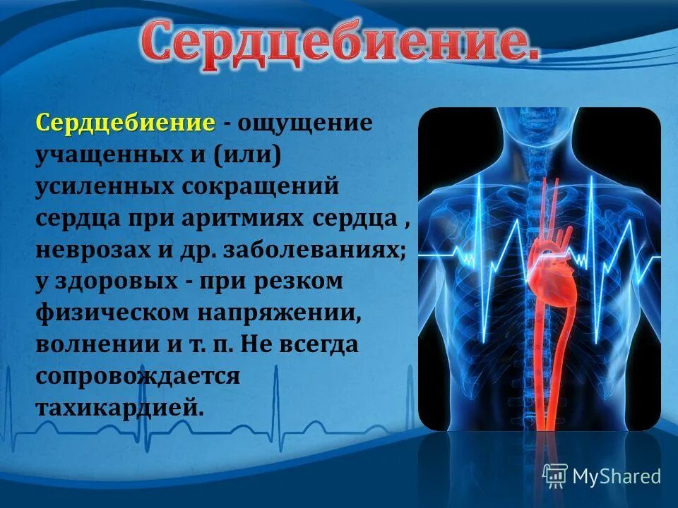 Симптомы при тахикардии. Ощущение сердцебиения. Сердцебиение ударов в минуту. Стучит сердце при нормальном пульсе. Сердцебиение и перебои в работе сердца.
