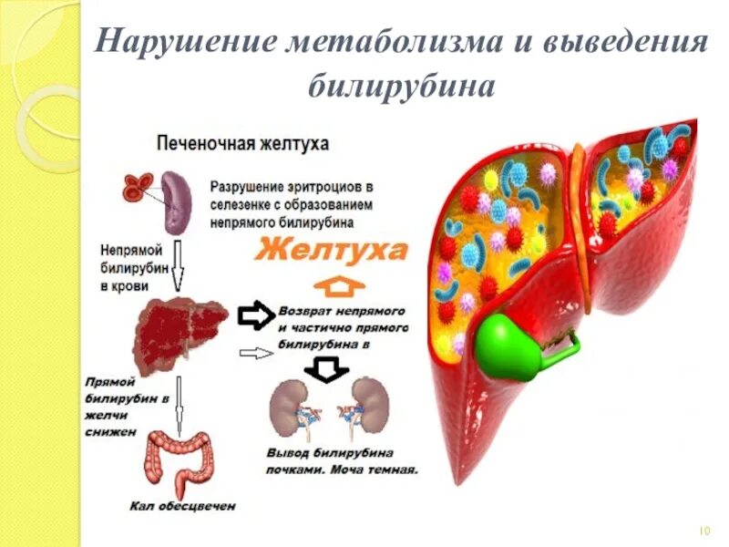 Патология обмена веществ. Нарушения выведения билирубина. Нарушенный обмен веществ. Нарушение обменных процессов в организме.