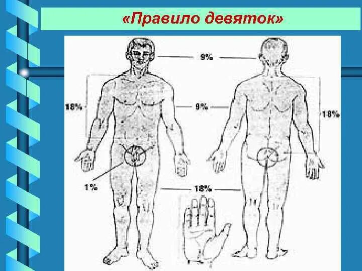 Правило ладони правило девяток