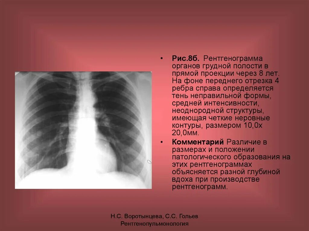 Неоднородное округлое образование