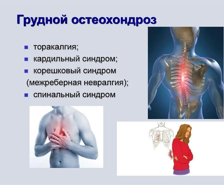 Боль в спине трудно дышать. Грудной остеохондроз. Грудной остеохондроз симптомы. Остеохондроз грудного отдела симптомы. Локализация боли при грудном остеохондрозе.