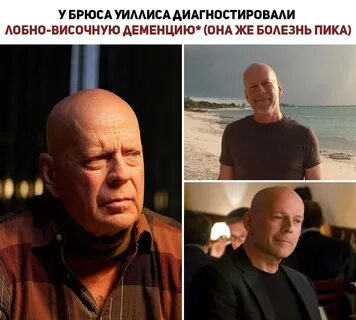 Брюс уиллис деменция сколько