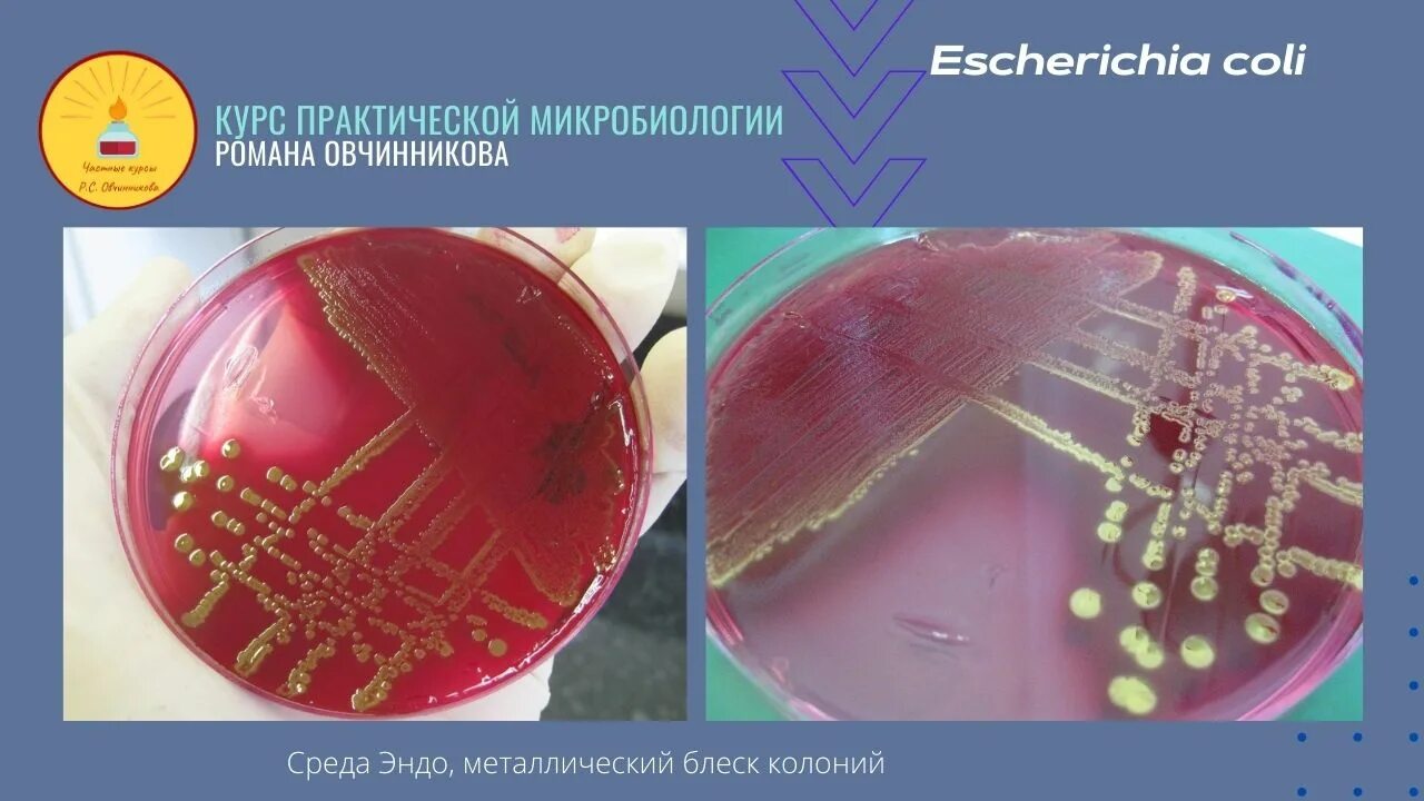 Escherichia coli что это у мужчин. Escherichia coli на среде Эндо. Колонии эшерихии коли. Колонии эшерихии коли на среде Эндо. Escherichia coli на питательной среде.